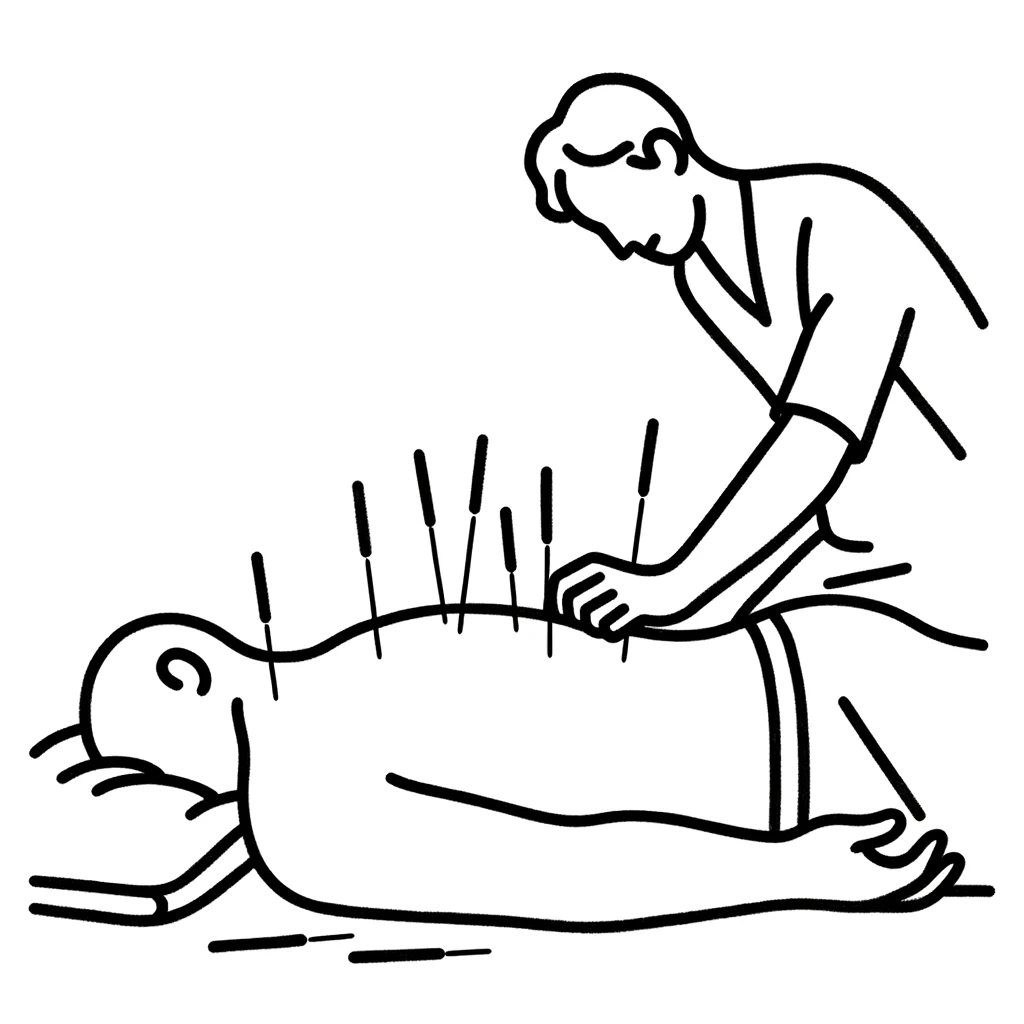 puncio seca fisioterapia